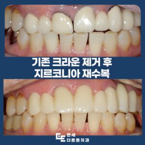 수락산역치과