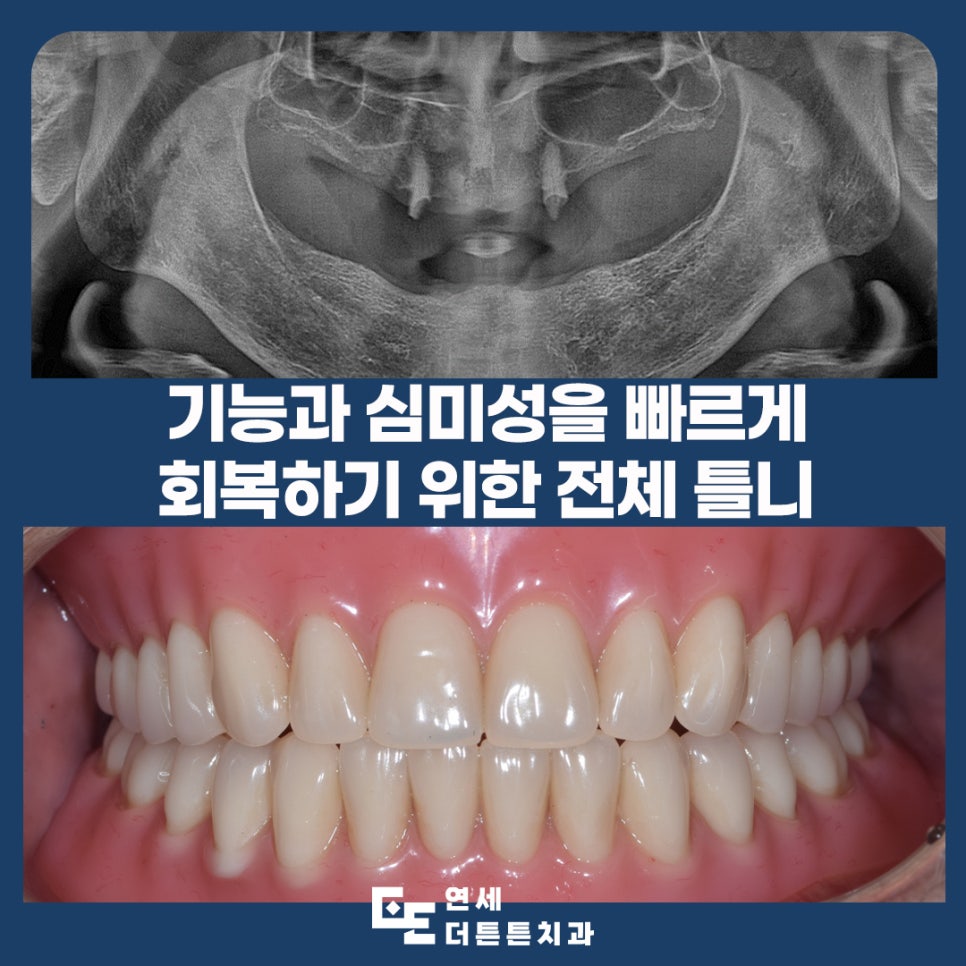 수락산역치과