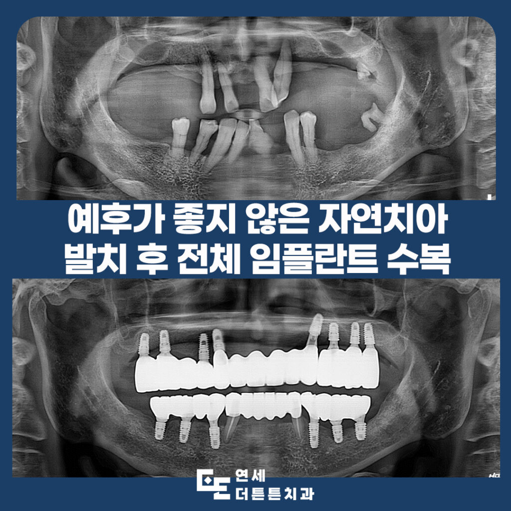 망월사역치과