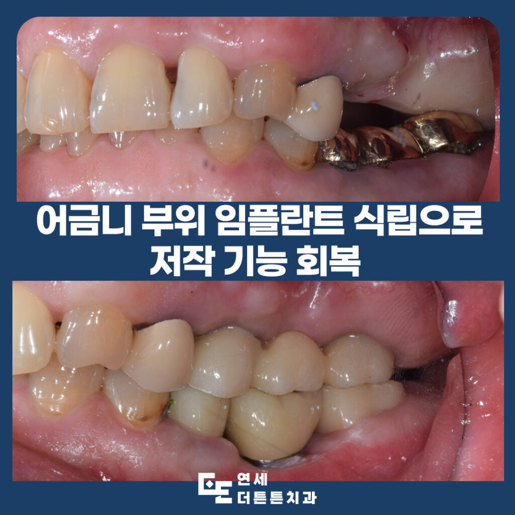 망월사역치과