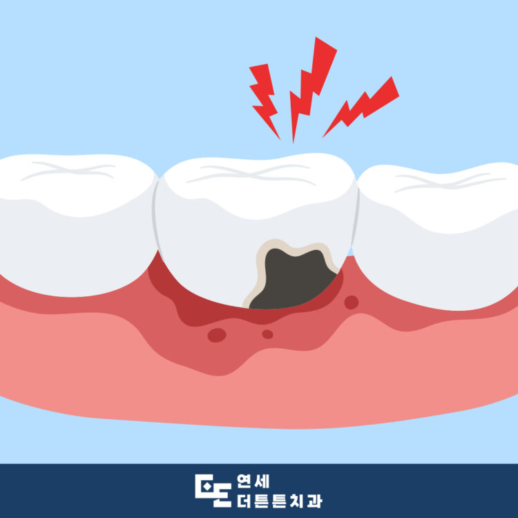 망월사역치과
