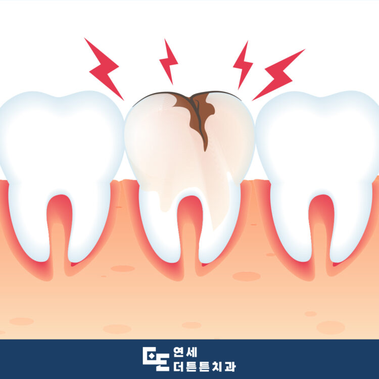망월사역치과
