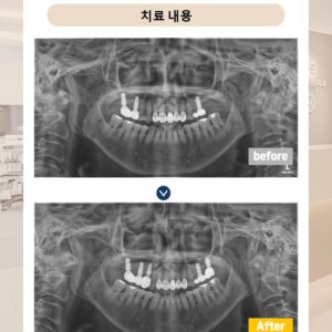 수락산역치과