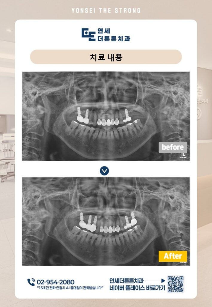 수락산역치과