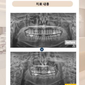 수락산역치과