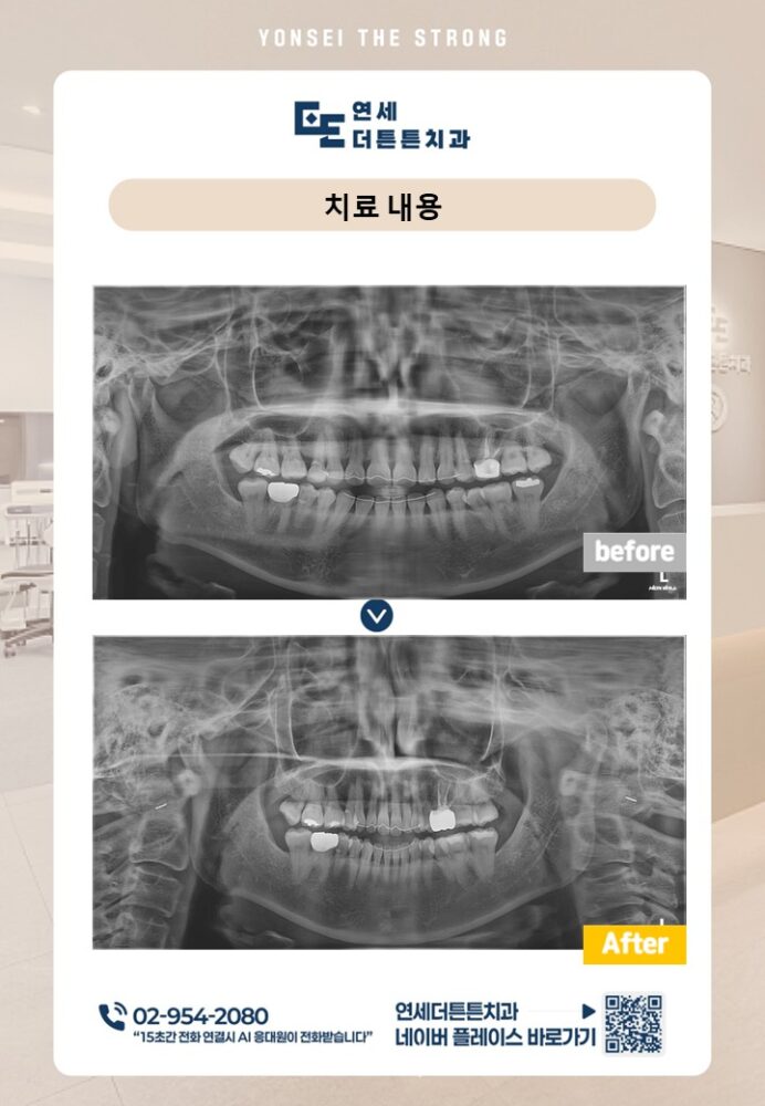 수락산역치과