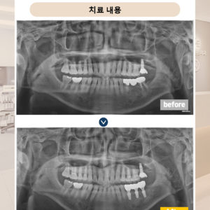 망월사역치과