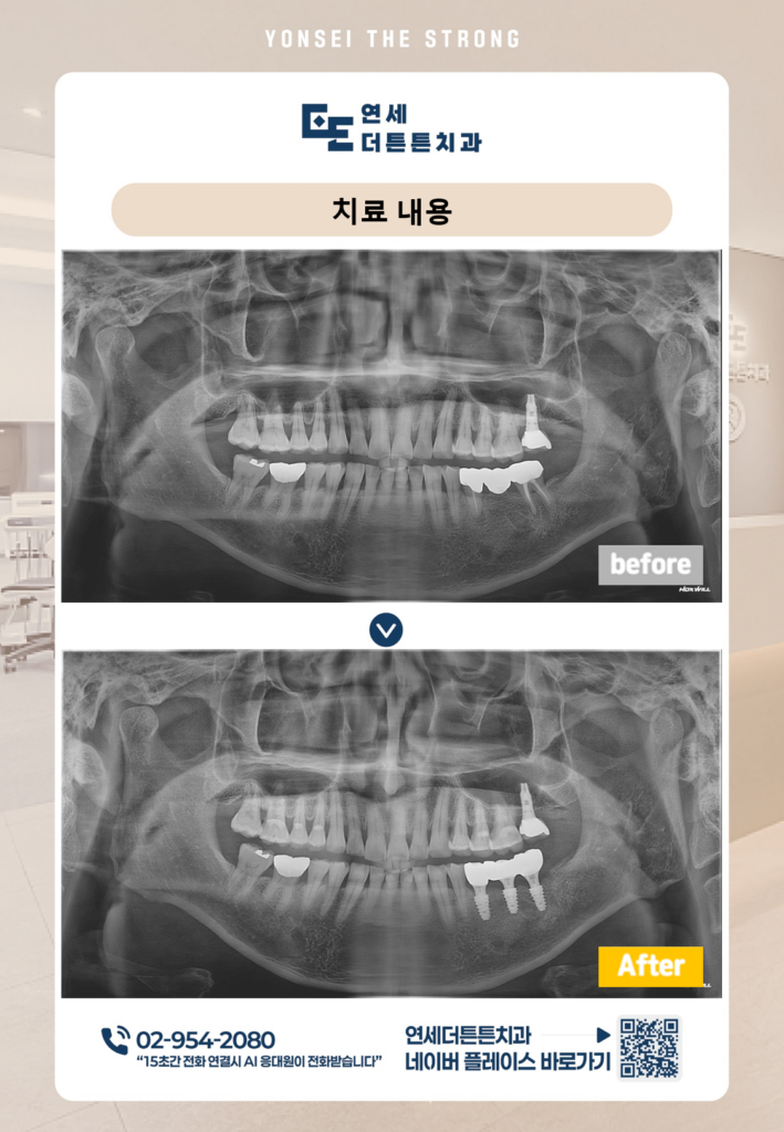 망월사역치과
