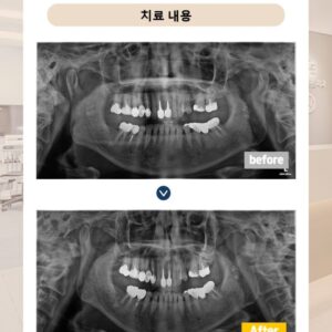 망월사역치과