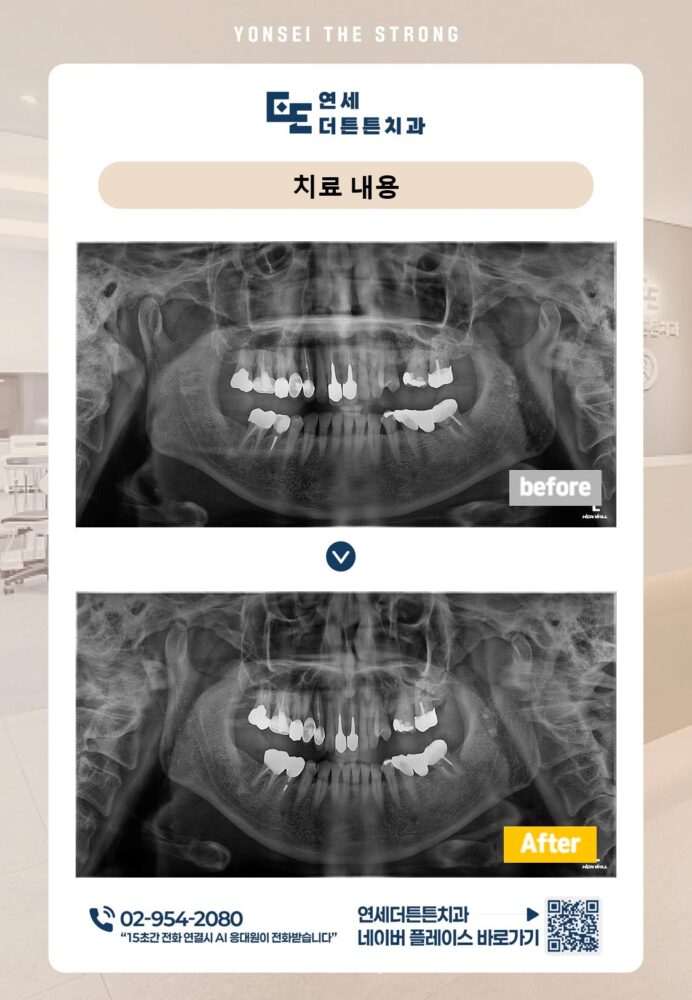 망월사역치과
