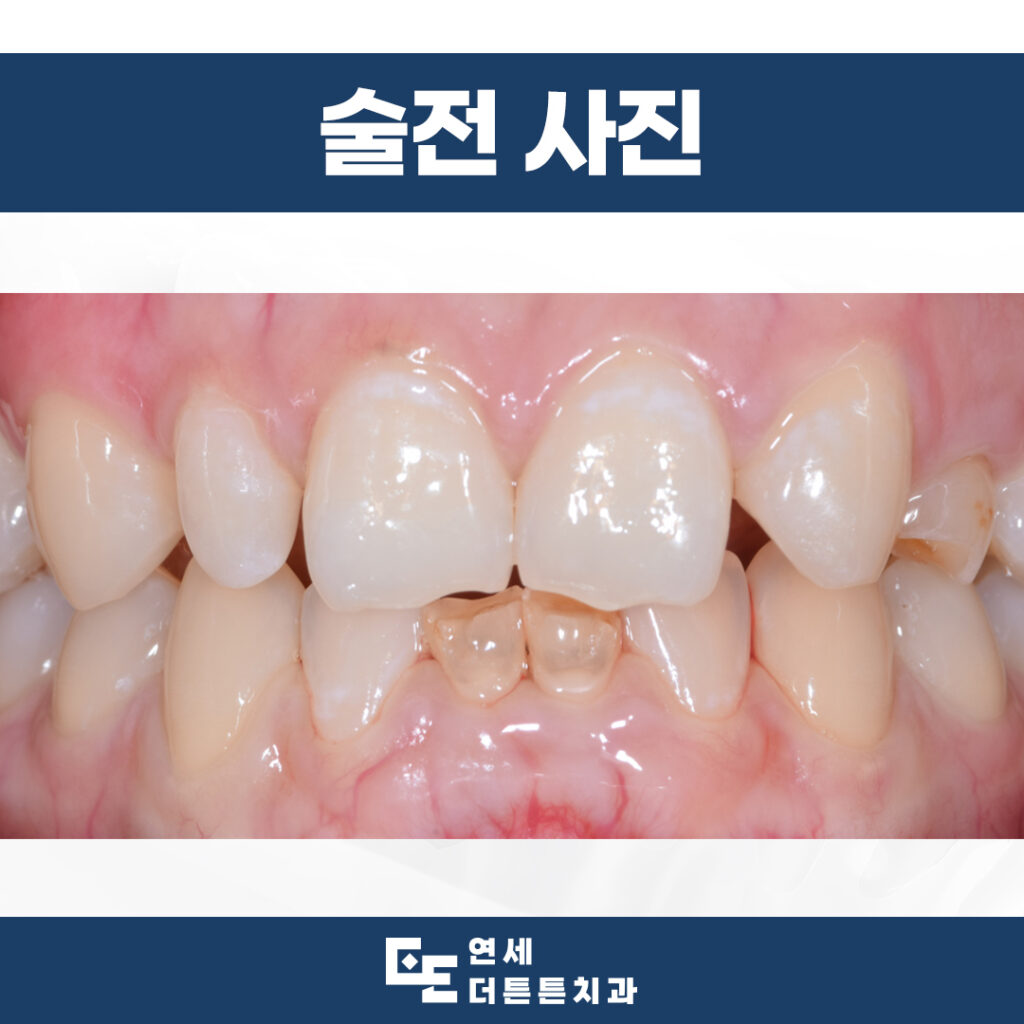 망월사역치과