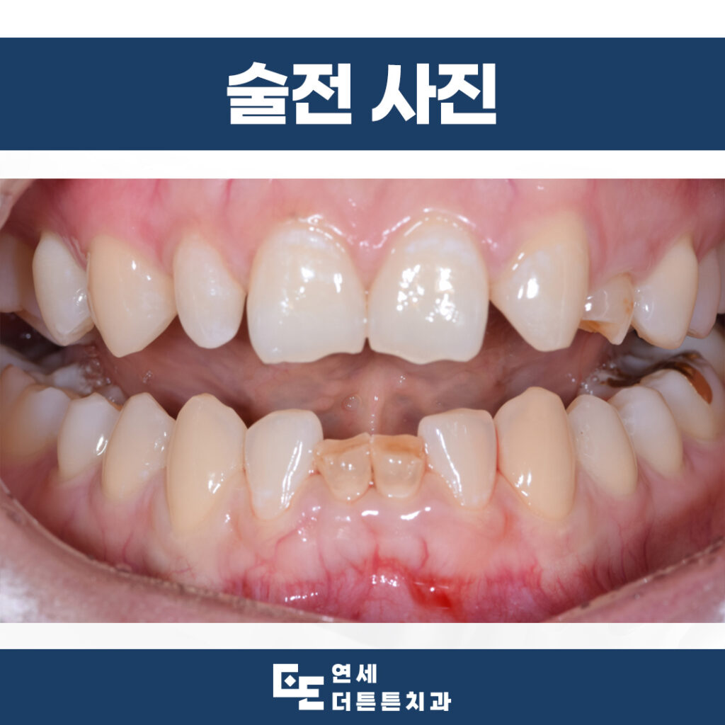 망월사역치과
