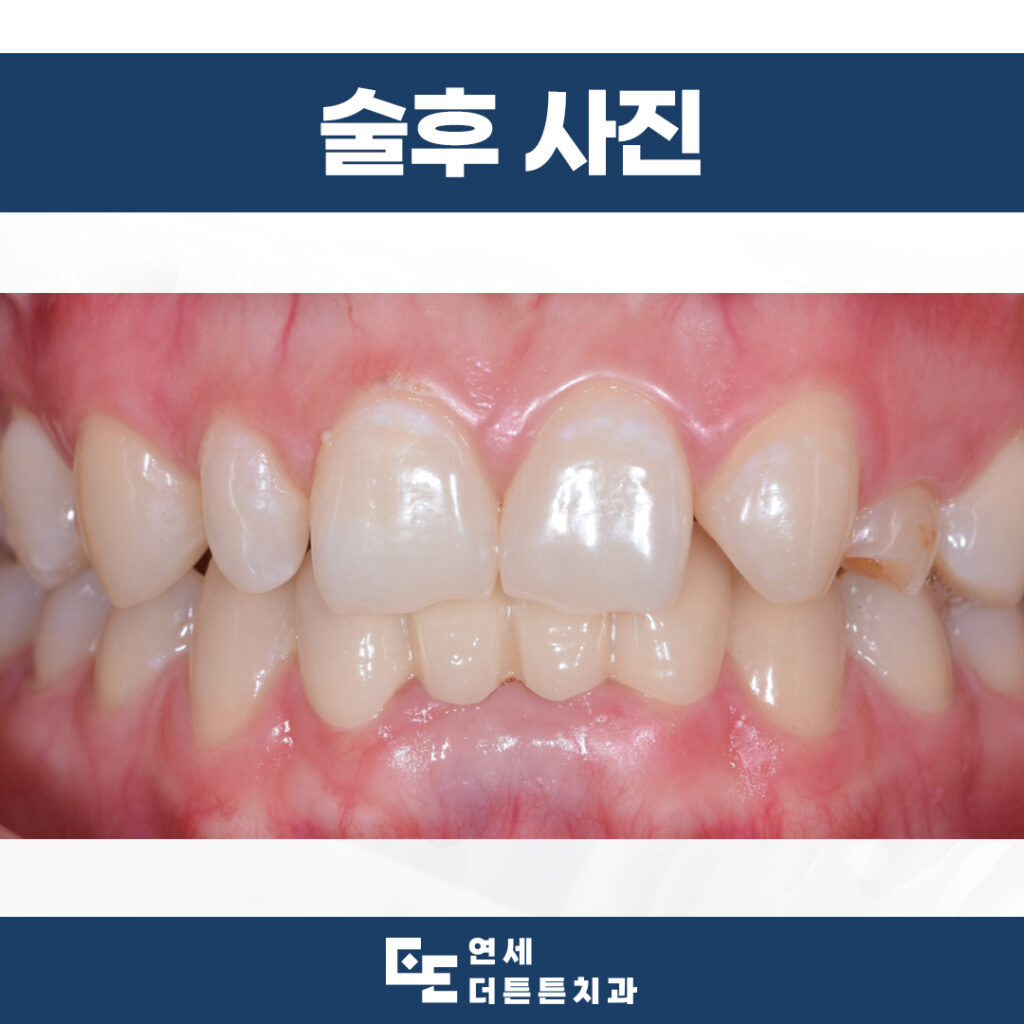망월사역치과