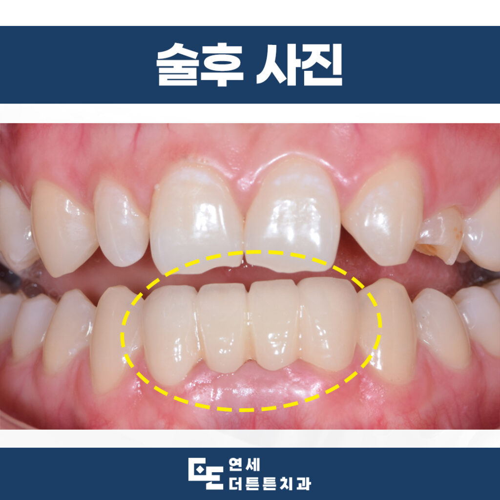 망월사역치과