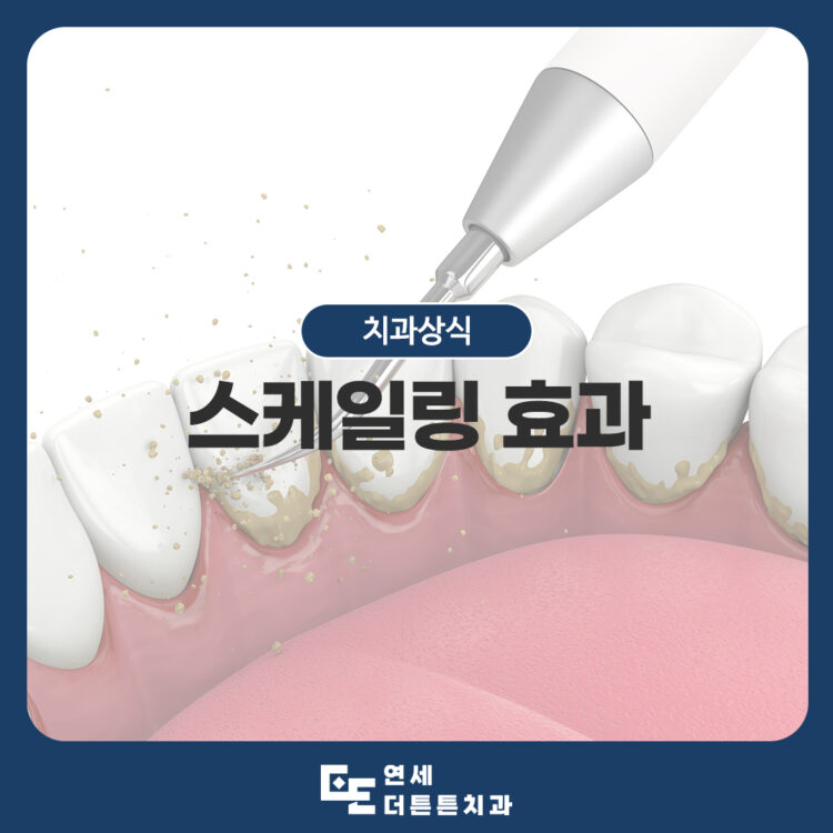 망월사역치과
