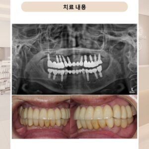 수락산역치과