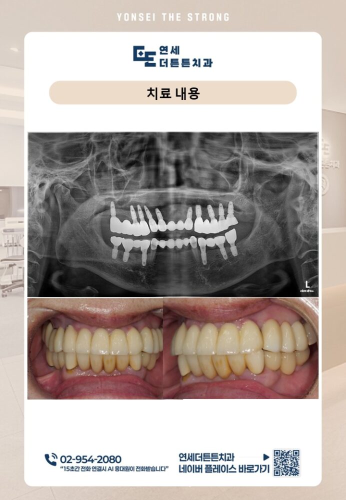 수락산역치과