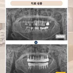 망월사역치과