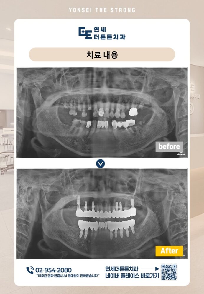 망월사역치과