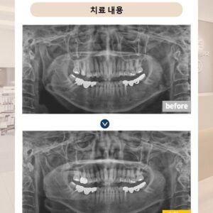 슬라이드13