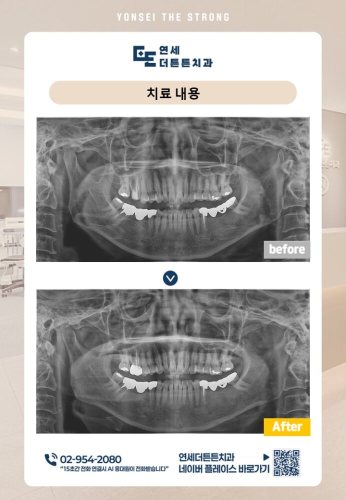 수락산역치과