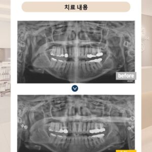 슬라이드14