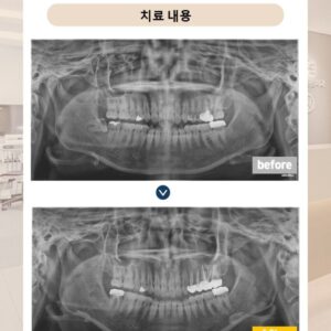 슬라이드15