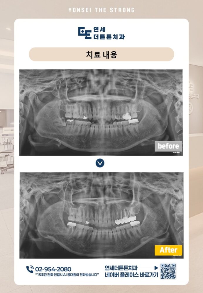 망월사역치과
