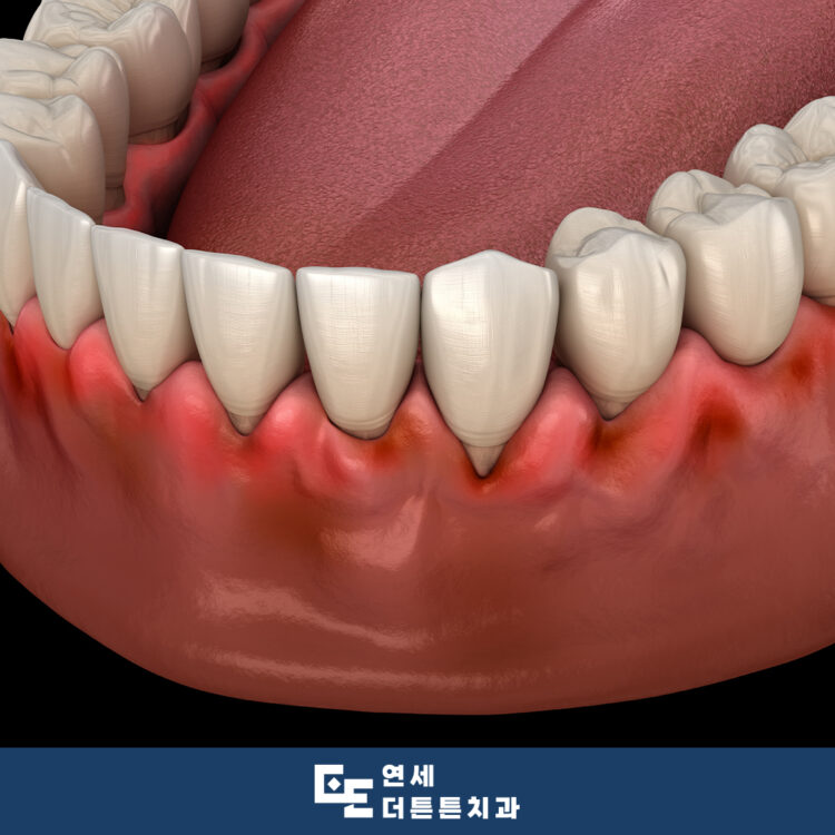 수락산역치과