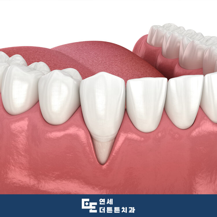 수락산역치과