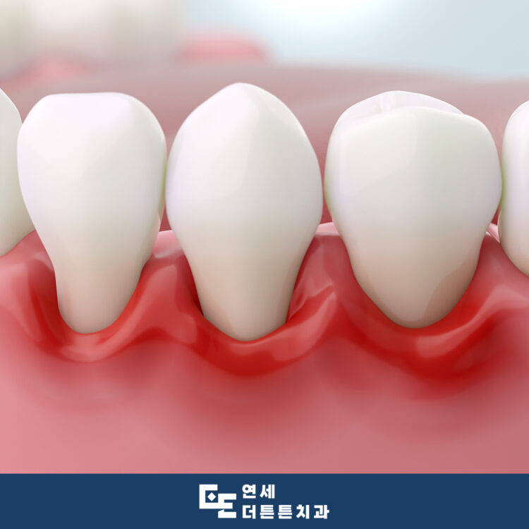 수락산역치과