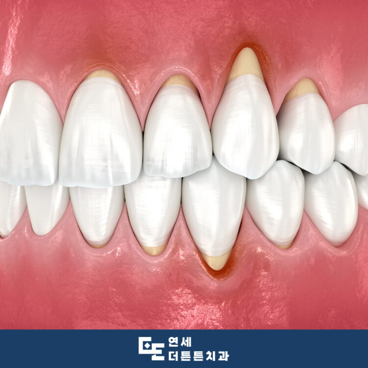 수락산역치과