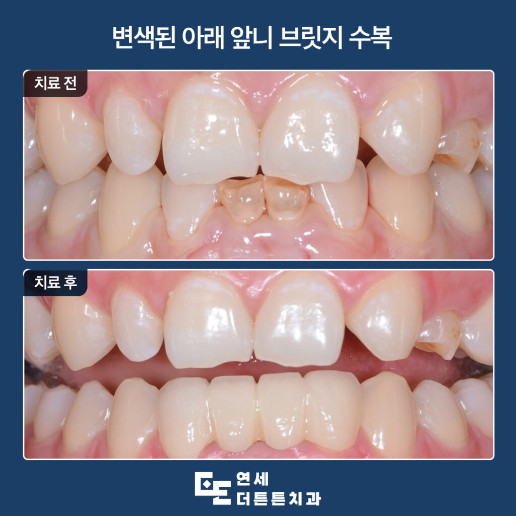 망월사역치과
