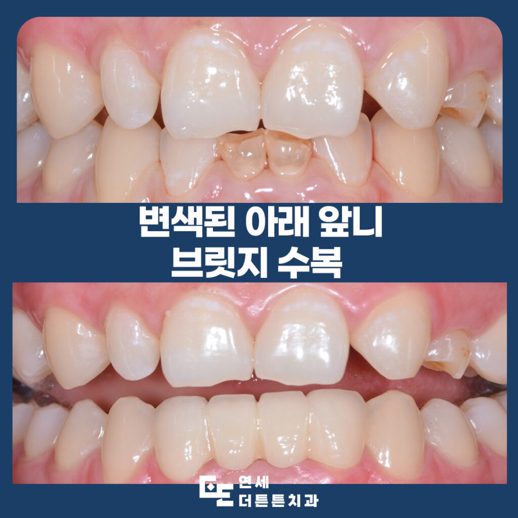 망월사역치과
