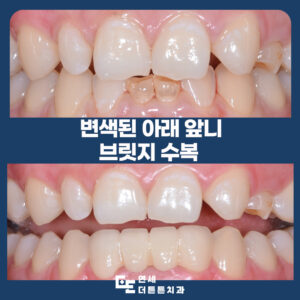 망월사역치과